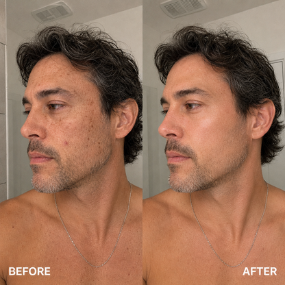 Budevia® Tranexamic Acid & Vitamin C Cream